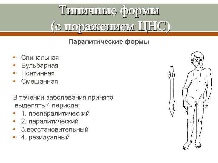 Типичные формы (с поражением ЦНС) Паралитические формы • • Спинальная Бульбарная Понтинная Смешанная В