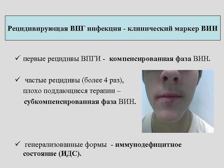 Рецидивирующая ВПГ инфекция - клинический маркер ВИН ü первые рецидивы ВПГИ - компенсированная фаза