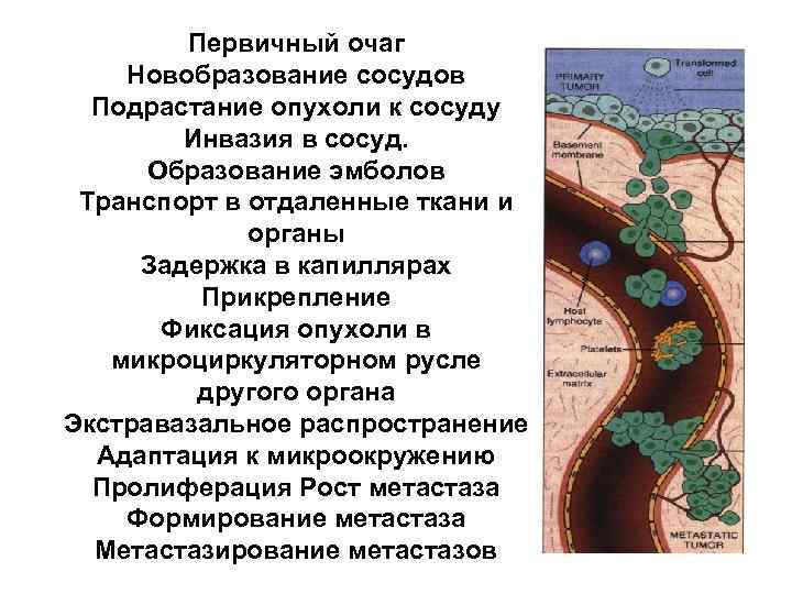 Первичный очаг Новобразование сосудов Подрастание опухоли к сосуду Инвазия в сосуд. Образование эмболов Транспорт
