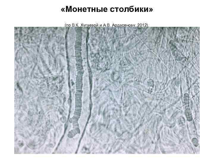 «Монетные столбики» (по В. К. Хугаевой и А. В. Ардасенову, 2012). 