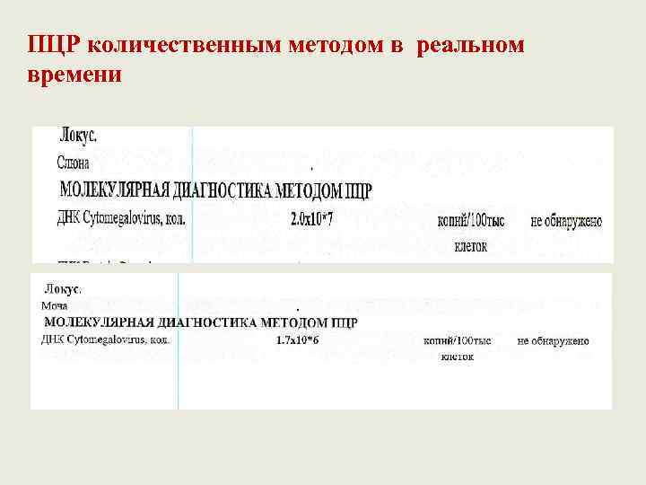 ПЦР количественным методом в реальном времени 