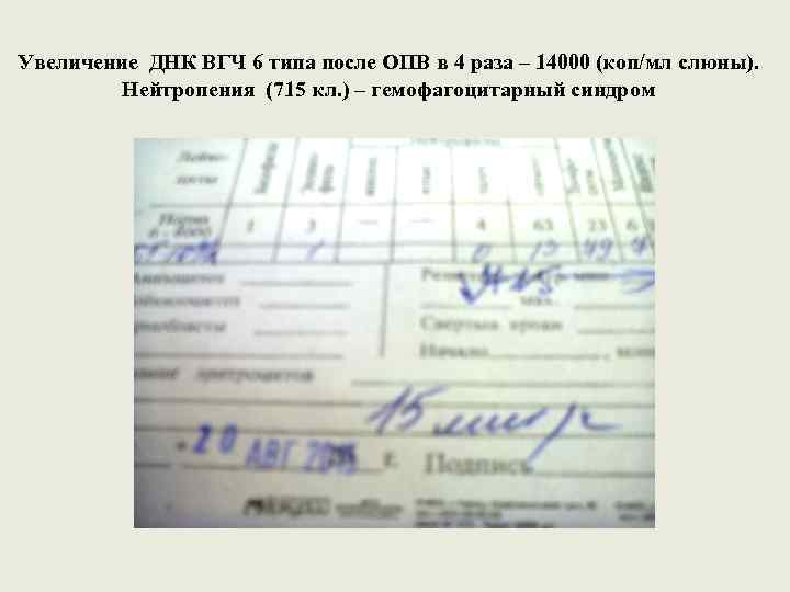 Увеличение ДНК ВГЧ 6 типа после ОПВ в 4 раза – 14000 (коп/мл слюны).