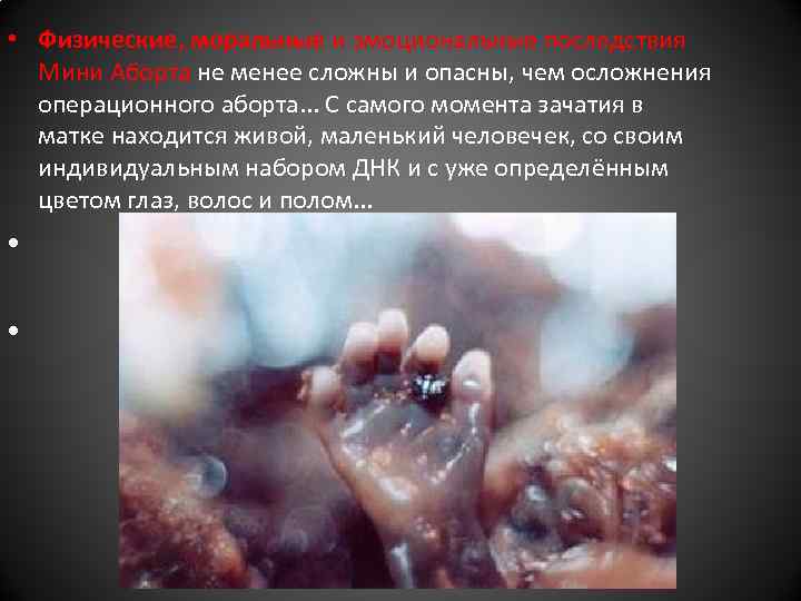  • Физические, моральные и эмоциональные последствия Мини Аборта не менее сложны и опасны,