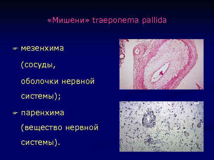  «Мишени» traeponema pallida F мезенхима (сосуды, оболочки нервной системы); F паренхима (вещество нервной