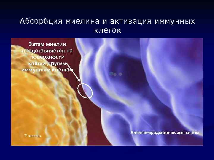 Абсорбция миелина и активация иммунных клеток Затем миелин представляется на поверхности клетки другим иммунным