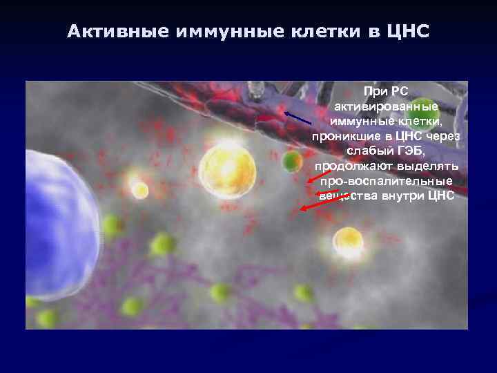 Активные иммунные клетки в ЦНС При РС активированные иммунные клетки, проникшие в ЦНС через