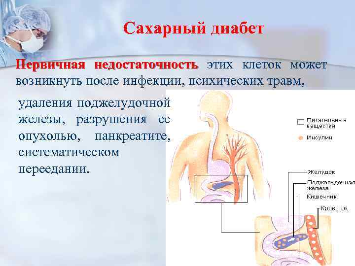 Сахарный диабет Первичная недостаточность этих клеток может возникнуть после инфекции, психических травм, удаления поджелудочной