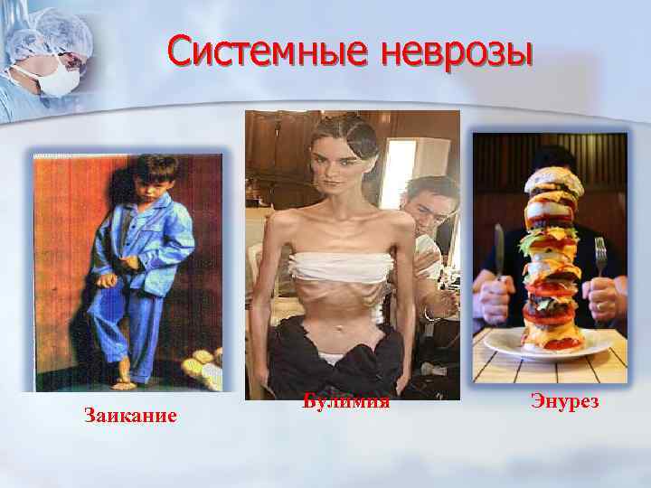 Системные неврозы Заикание Булимия Энурез 