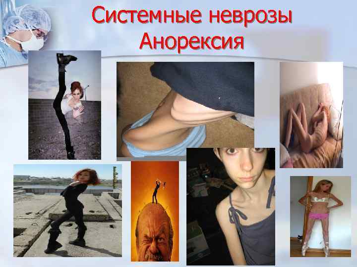 Системные неврозы Анорексия 