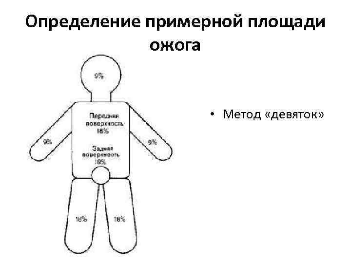 Правила определения площади ожогов