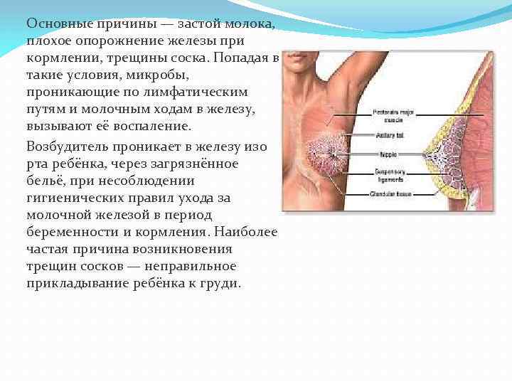 Основные причины — застой молока, плохое опорожнение железы при кормлении, трещины соска. Попадая в