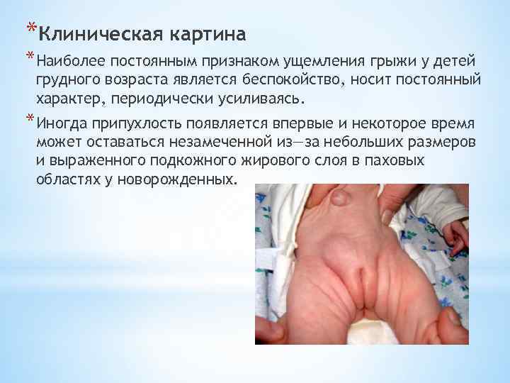 *Клиническая картина *Наиболее постоянным признаком ущемления грыжи у детей грудного возраста является беспокойство, носит