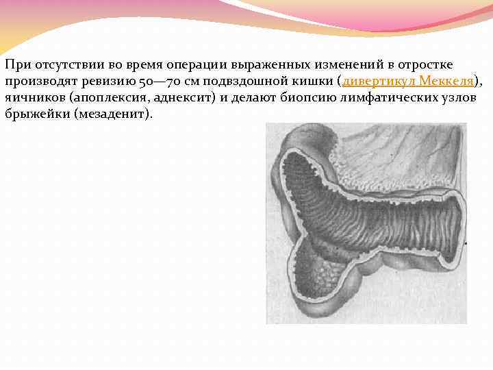 Недостаточность илеоцекального клапана кишечника