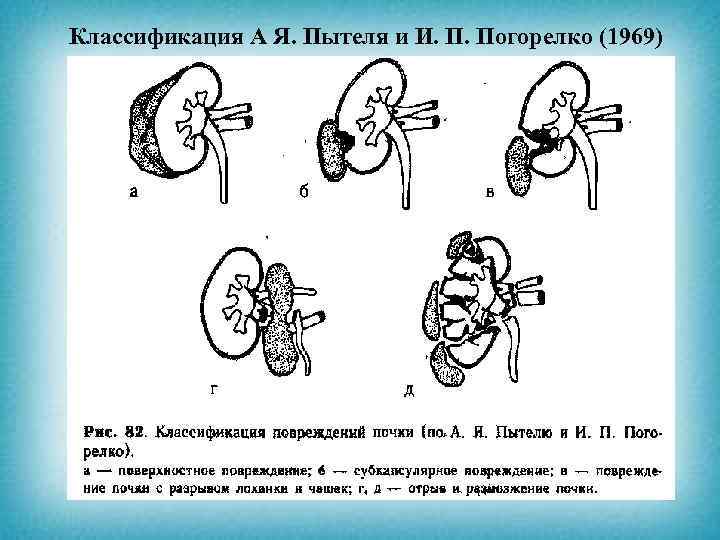 Классификация А Я. Пытеля и И. П. Погорелко (1969) 