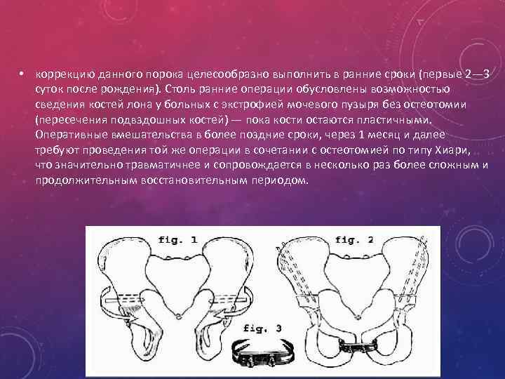  • коррекцию данного порока целесообразно выполнить в ранние сроки (первые 2— 3 суток