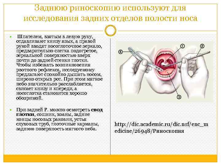 Заднюю риноскопию используют для исследования задних отделов полости носа Шпателем, взятым в левую руку,