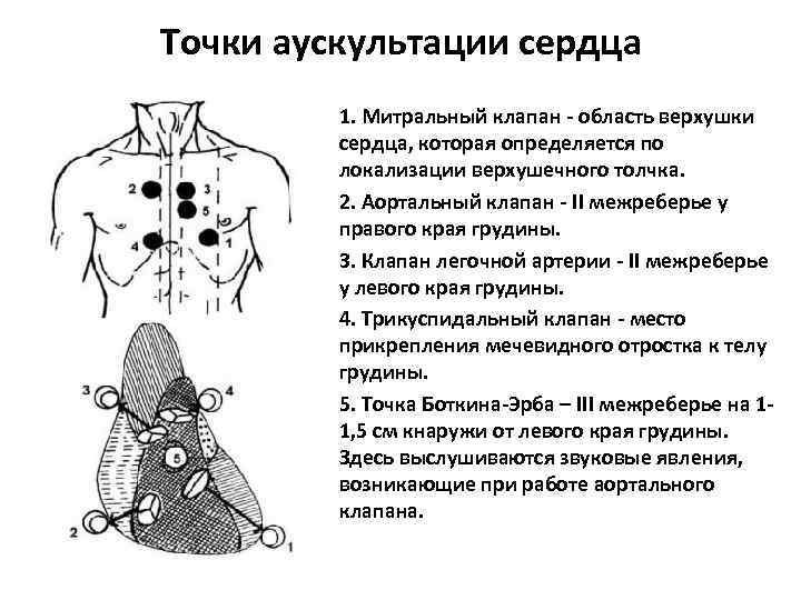 Операция на сердечный клапан