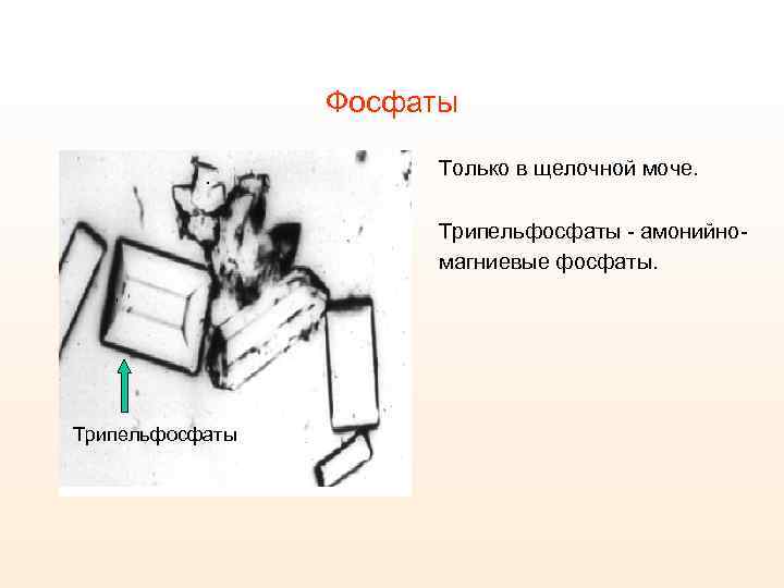 Презентация гериатрические аспекты в нефрологии