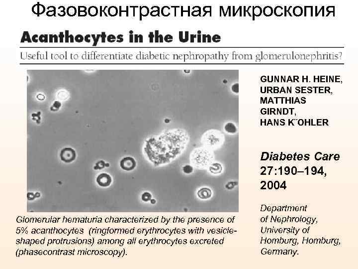 Фазовоконтрастная микроскопия GUNNAR H. HEINE, URBAN SESTER, MATTHIAS GIRNDT, HANS K¨OHLER Diabetes Care 27: