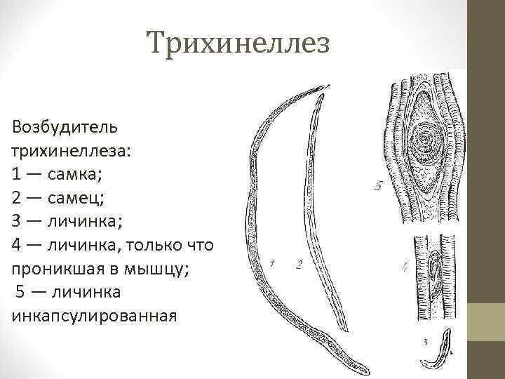 Трихинеллез Возбудитель трихинеллеза: 1 — самка; 2 — самец; 3 — личинка; 4 —