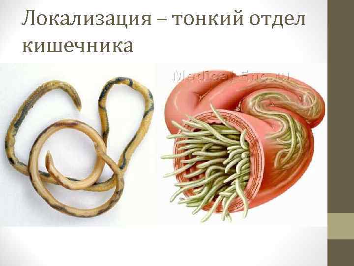 Локализация – тонкий отдел кишечника 