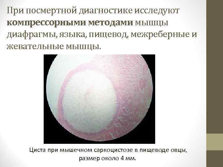 При посмертной диагностике исследуют компрессорными методами мышцы диафрагмы, языка, пищевод, межреберные и жевательные мышцы.