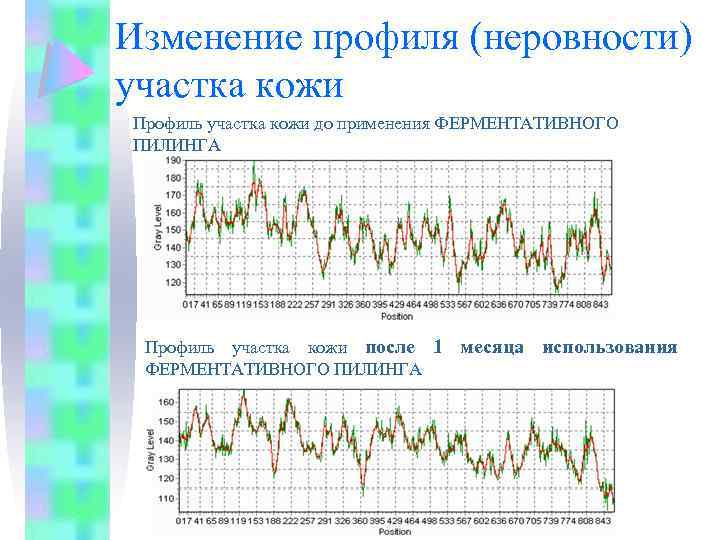 Изменение профиля (неровности) участка кожи Профиль участка кожи до применения ФЕРМЕНТАТИВНОГО ПИЛИНГА Профиль участка