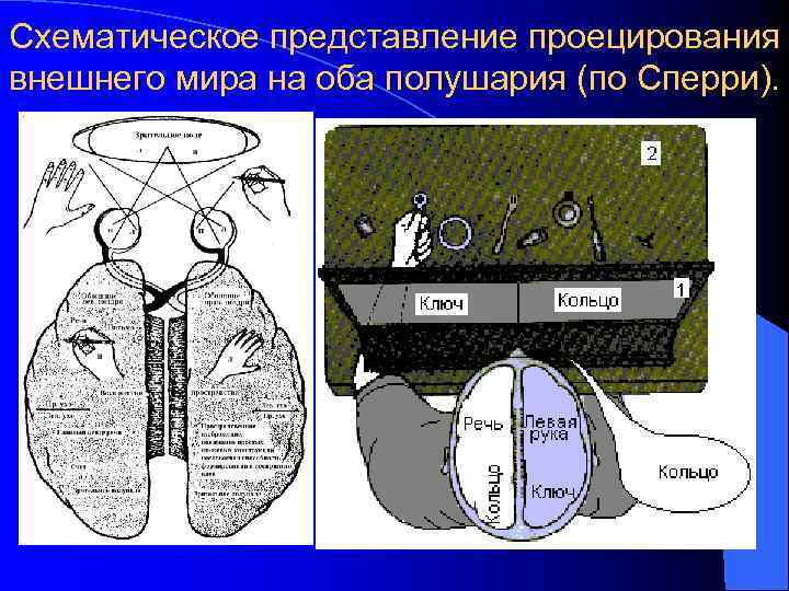 Схематическое представление проецирования внешнего мира на оба полушария (по Сперри). 