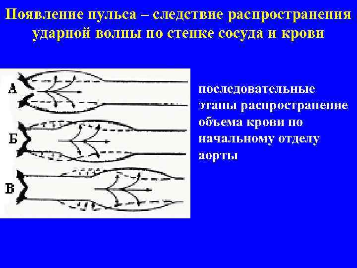 Появление пульса – следствие распространения ударной волны по стенке сосуда и крови • последовательные
