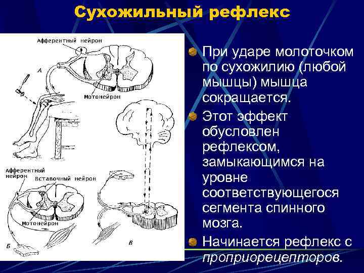 Схема сухожильного рефлекса