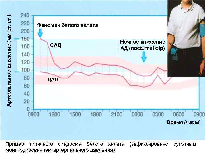 Артериальное давление (мм рт. ст. ) Феномен белого халата САД Ночное снижение АД (nocturnal
