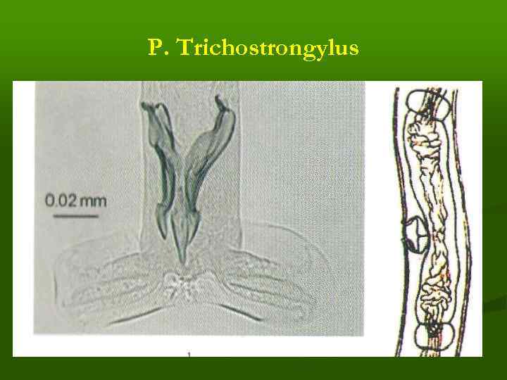 Р. Trichostrongylus 
