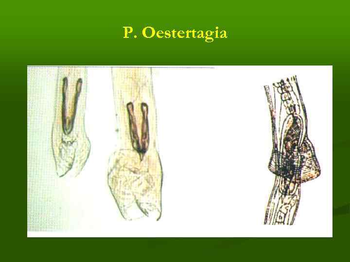 Р. Oestertagia 