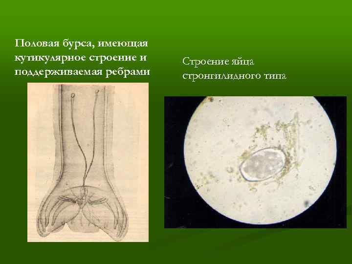 Половая бурса, имеющая кутикулярное строение и поддерживаемая ребрами Строение яйца стронгилидного типа 