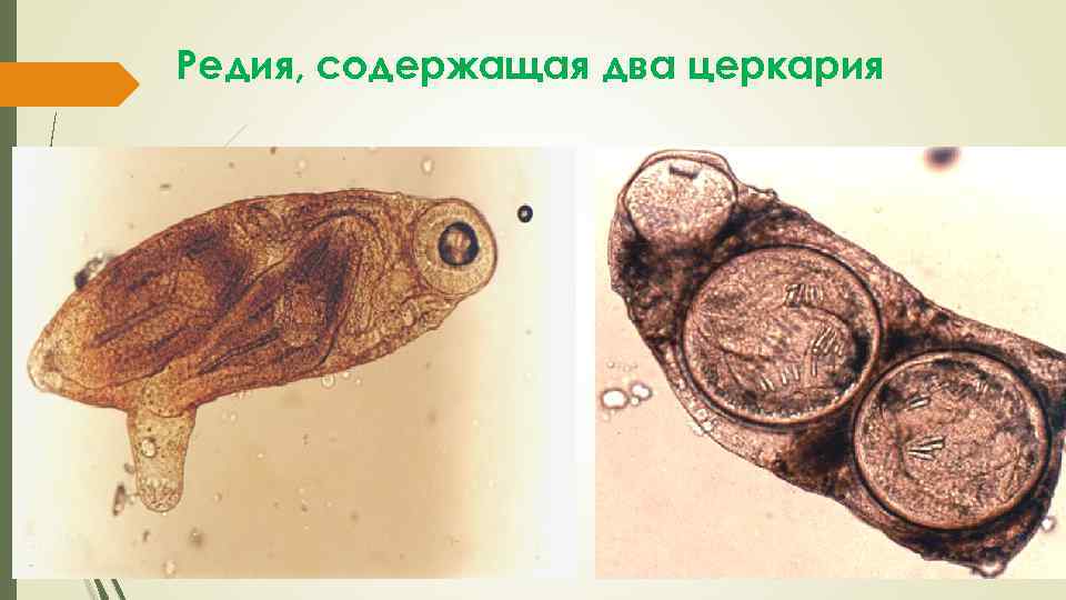 Редия, содержащая два церкария 