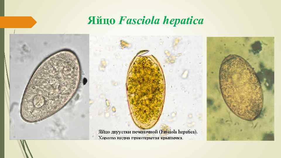 Яйцо Fasciola hepatica 