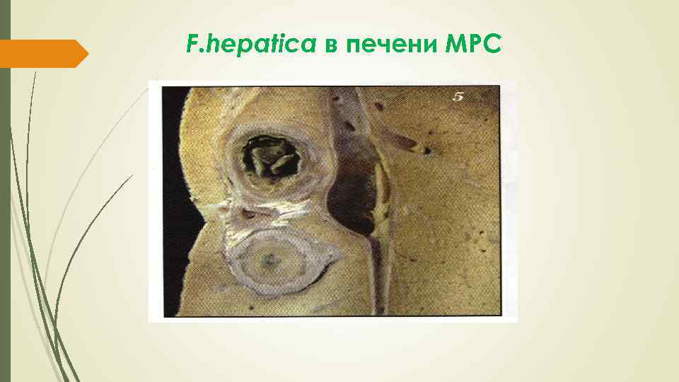 F. hepatica в печени МРС 