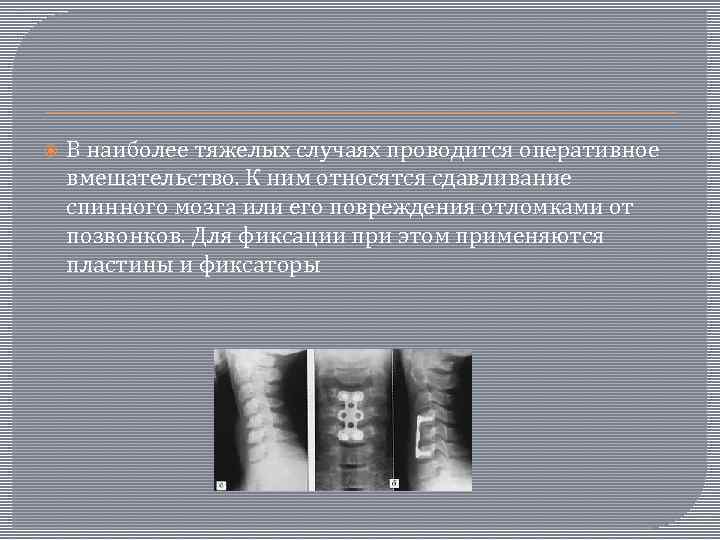  В наиболее тяжелых случаях проводится оперативное вмешательство. К ним относятся сдавливание спинного мозга