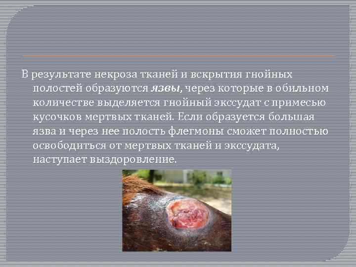 В результате некроза тканей и вскрытия гнойных полостей образуются язвы, через которые в обильном