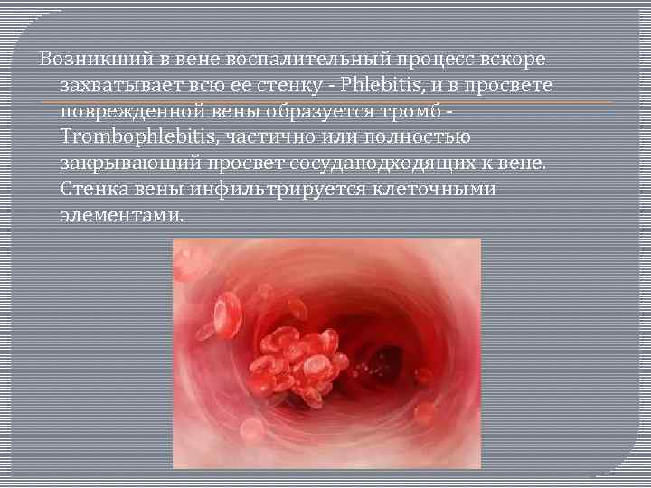 Возникший в вене воспалительный процесс вскоре захватывает всю ее стенку - Phlebitis, и в