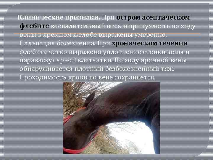  Клинические признаки. При остром асептическом флебите воспалительный отек и припухлость по ходу вены