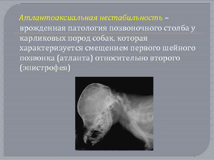  Атлантоаксиальная нестабильность – врожденная патология позвоночного столба у карликовых пород собак, которая характеризуется