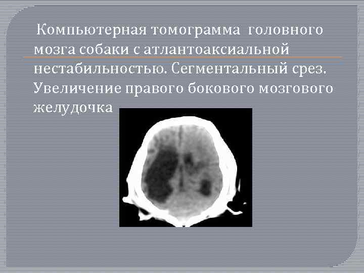  Компьютерная томограмма головного мозга собаки с атлантоаксиальной нестабильностью. Сегментальный срез. Увеличение правого бокового