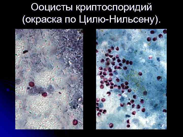 Ооцисты криптоспоридий (окраска по Цилю-Нильсену). 