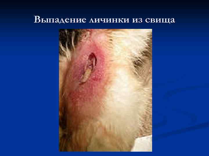 Выпадение личинки из свища 