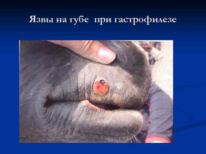 Язвы на губе при гастрофилезе 