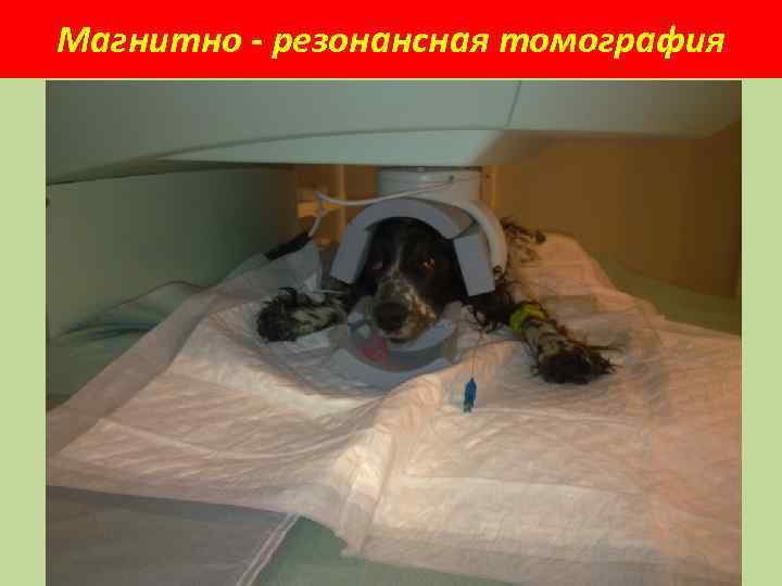 Магнитно - резонансная томография 