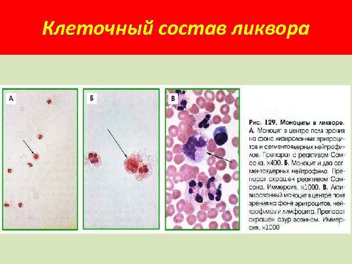 Клеточный состав ликвора 