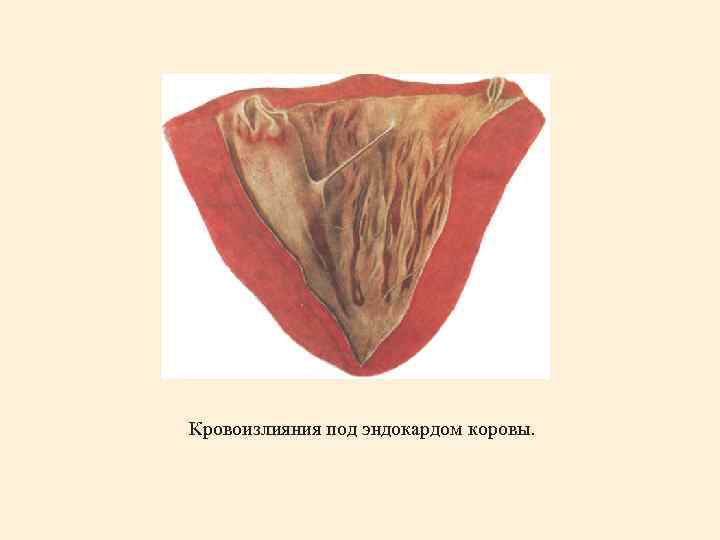  Кровоизлияния под эндокардом коровы. 