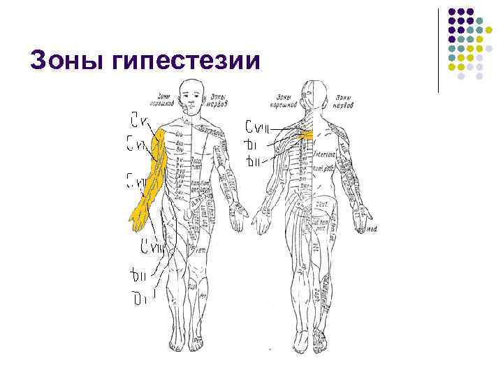 Зоны гипестезии 